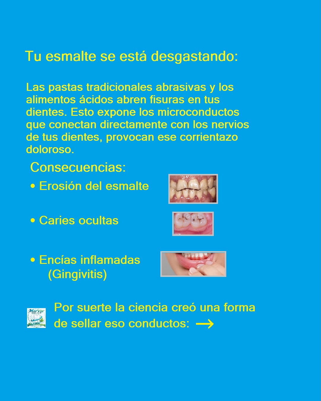 Sensitive Teeth, Premium nHAP Toothpaste, Fluoride-Free